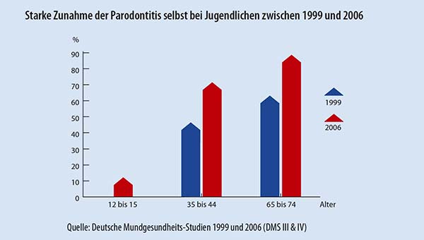 Parodontitis-Studie